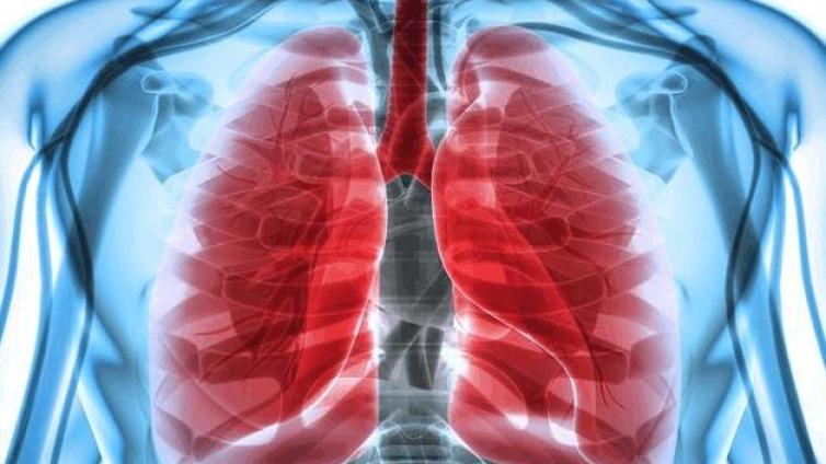 肺癌影像学筛查进展——为什么要筛查