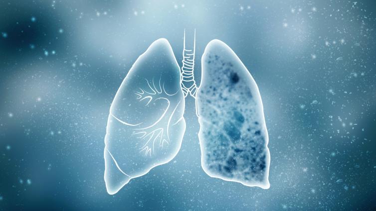 肺结节影像分级与评估系统——PNI-GADS系统的重要指标