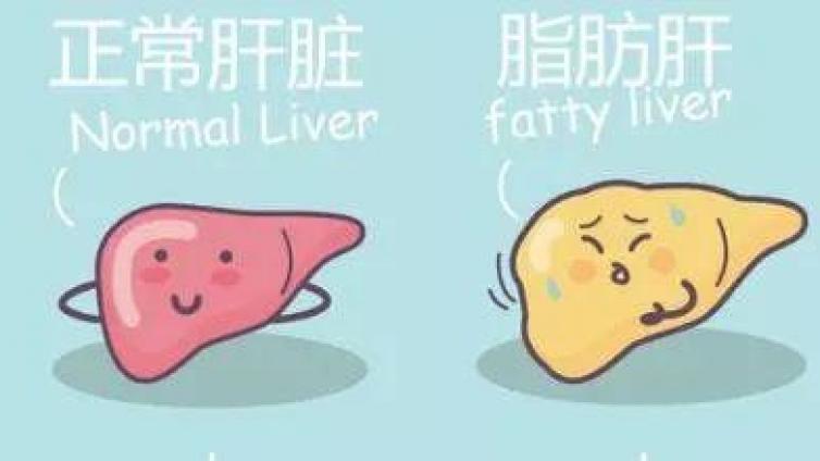 肝脂肪变性的典型分布和部位