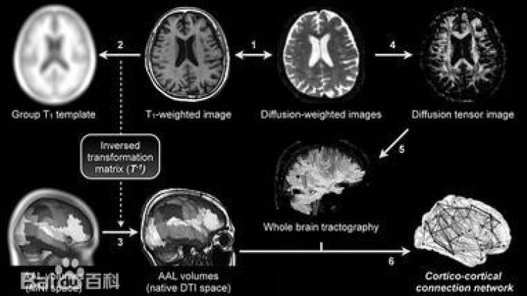 fMRI适应证、脑功能成像