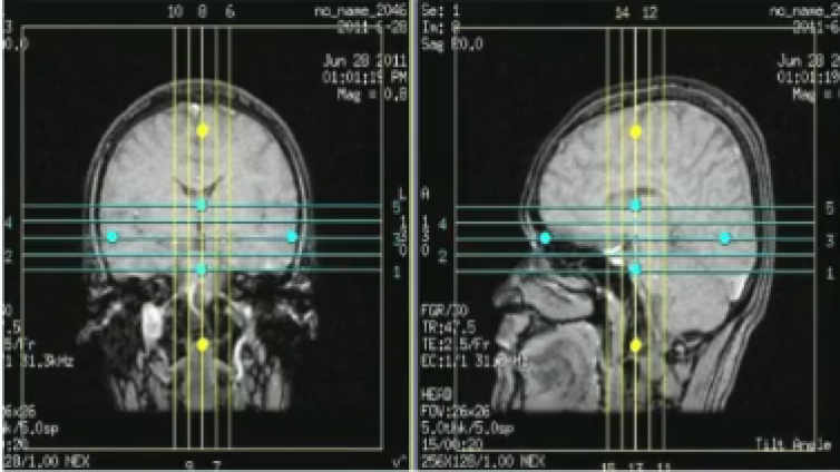 fMRI成像设备、任务态fMRI、特殊准备