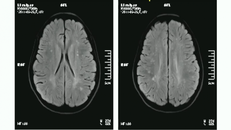 静息态fMRI