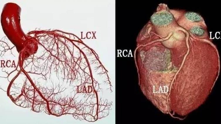 心率与冠状动脉个分支段最佳显示时相段关系∶