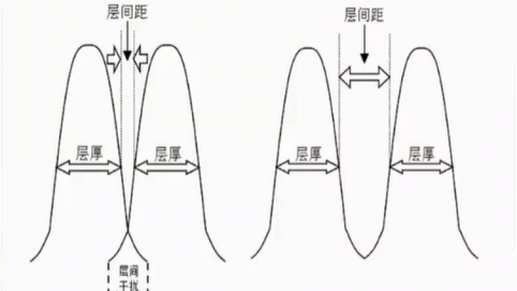 膝关节MRI扫描规范：矩阵、视野、层间隔