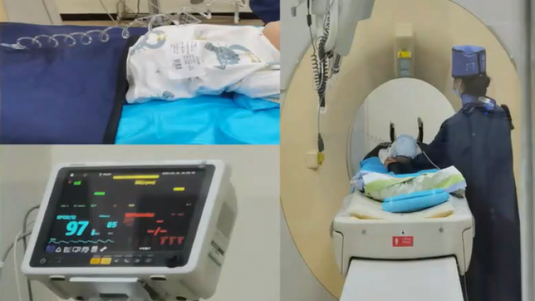 儿童胸部增强CT检查方法和扫描参数平扫