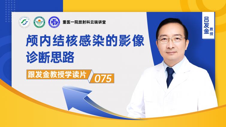 颅内结核感染的影像诊断思路——小结